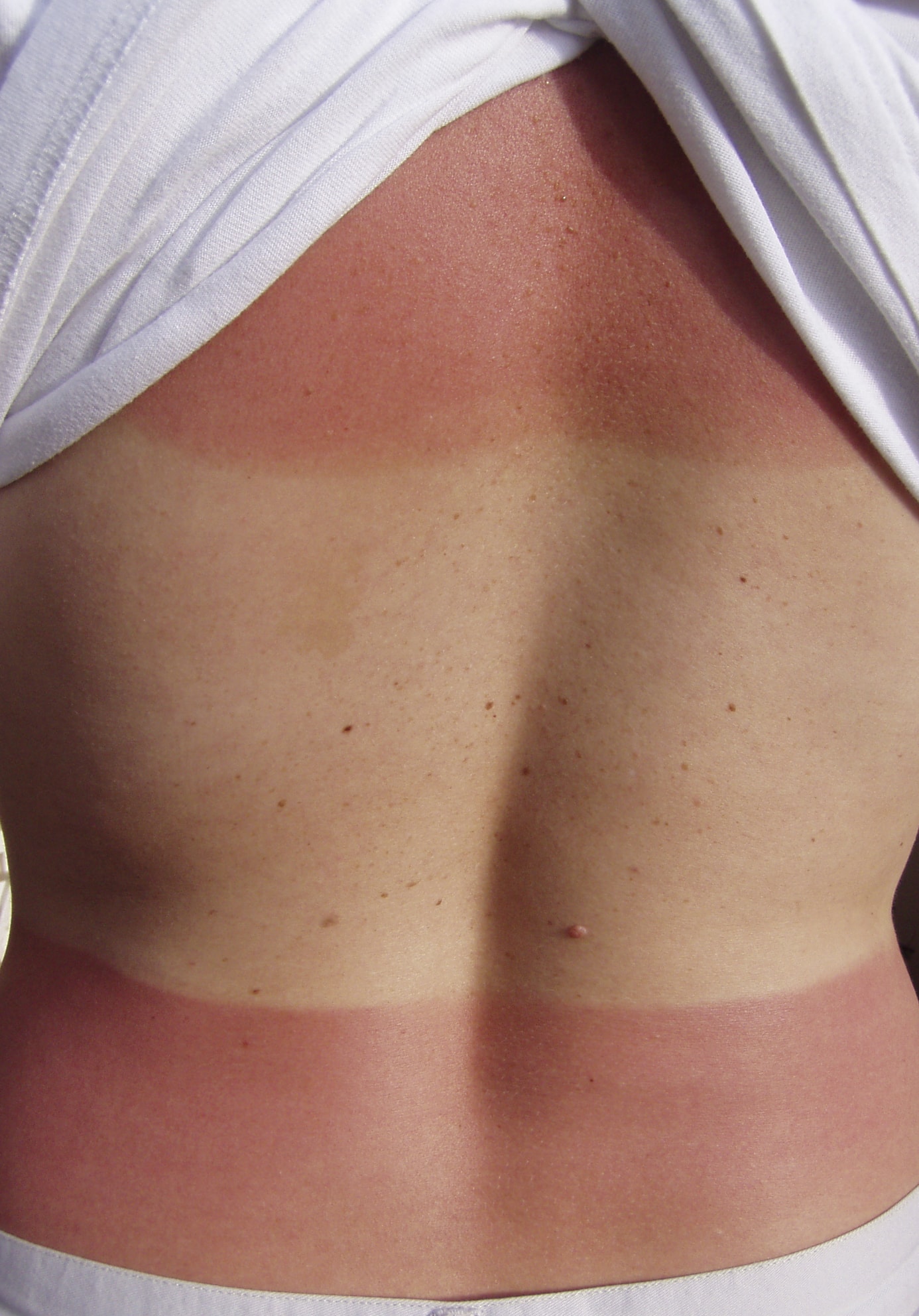 iStock_000000213966Medium.jpg