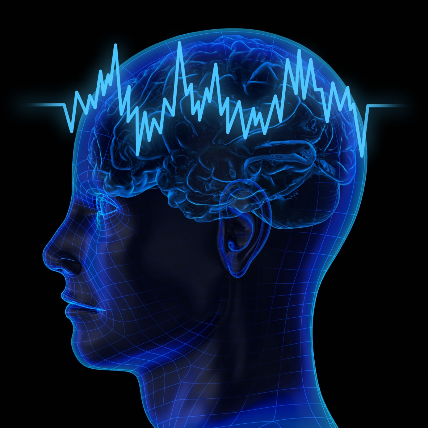 iStock_000017472498Medium.jpg