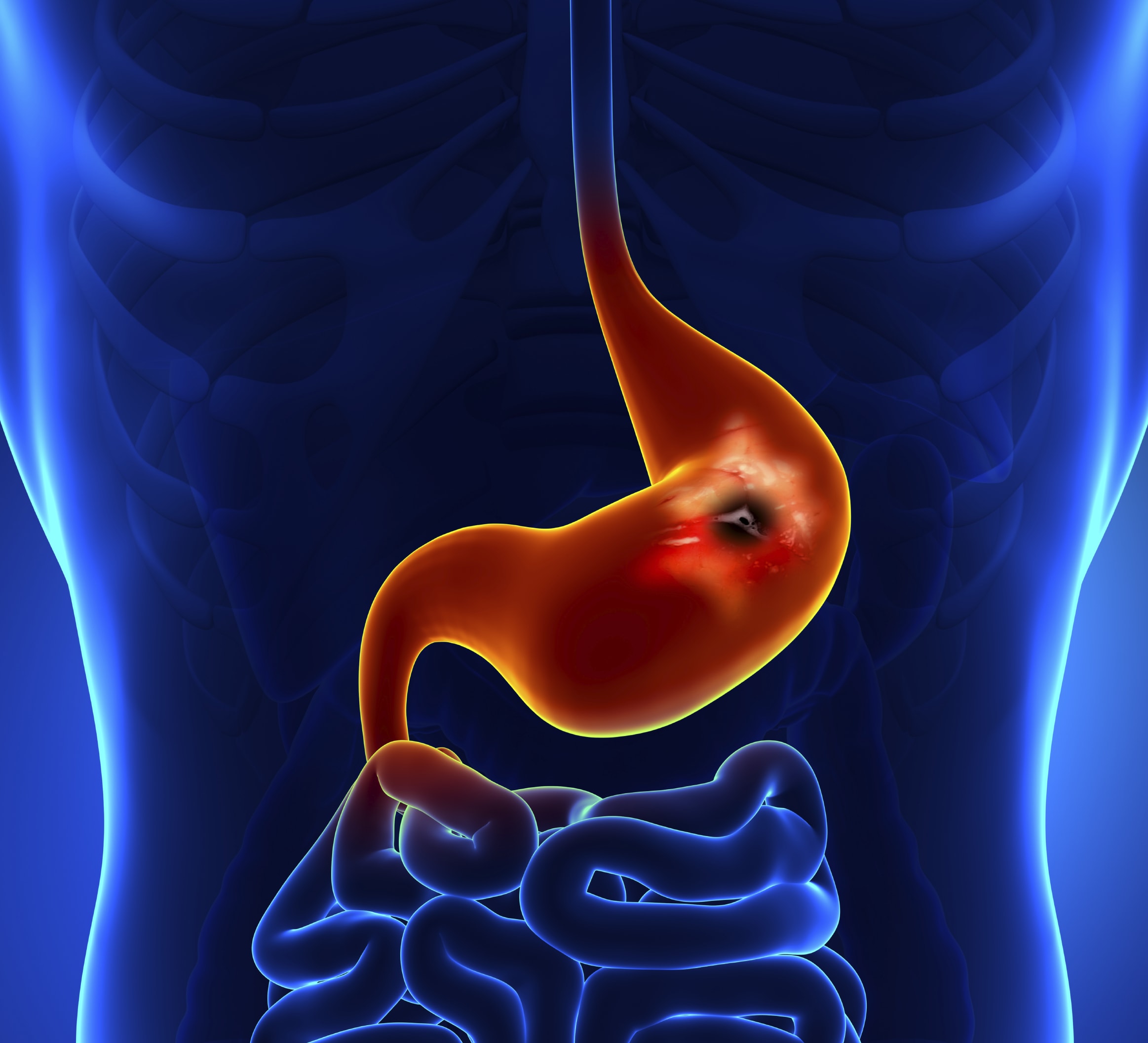 iStock_000041361128Large.jpg